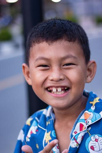 Cara Mengatasi Gigi Berlubang Dengan Bahan Alami